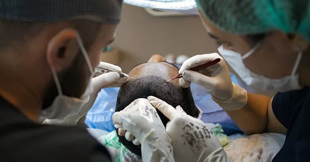 Il trapianto dei capelli a Roma non è solo una questione estetica, ma anche di benessere personale. 